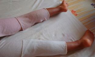 Compresse de vinaigre de cidre de pomme